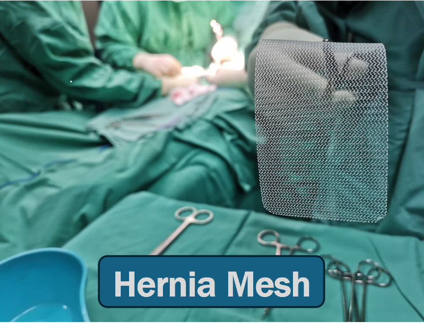 TortClaims Hernia Mesh Lawsuit